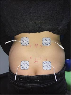 Low test–retest reliability of a protocol for assessing somatosensory cortex excitability generated from sensory nerves of the lower back